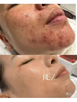 ミニ(MINI)/韓国ハブピンク