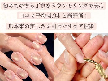 自爪のケアを重視した施術