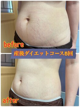 葡のか(ほのか)/ストレスゼロの産後ダイエット!