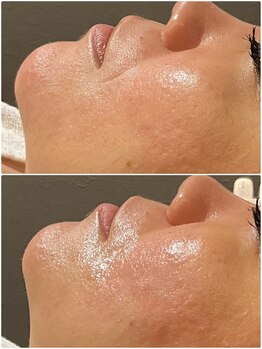 桜/即日☆小顔宣言♪