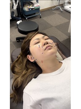 こうぞう整体院/美容鍼×筋膜リリース