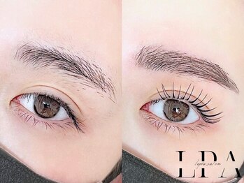 レピア 高槻店/韓国式LEPIA Before&After