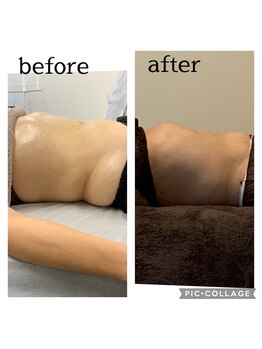 アミュレット(amulette)/結果重視★巡り痩身