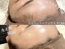 アルム(a'lm)の雰囲気（［ワックス脱毛］顔脱毛/生え際/眉毛ワックス/美眉/間引き）
