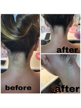 リンパサロン モア/うなじのワックス脱毛