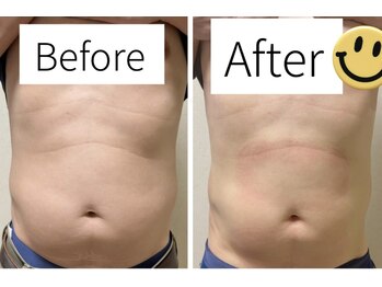 虹香(ニコ)/ぽっこりお腹に人気