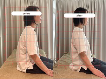 サンゴ(Sango)/猫背/肩こり/姿勢改善