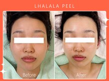 シロカネ 光の森店(SHIROKANE)/ララピール☆