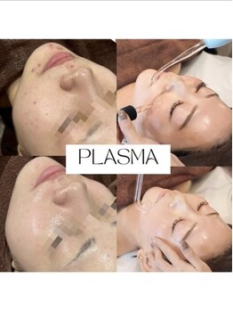 レア 姫路店(le'a)/プラズマレボリューション