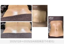 ビューティインベスト(Beauty INBEST)/肋骨ケア◎ウエスト/くびれ変化