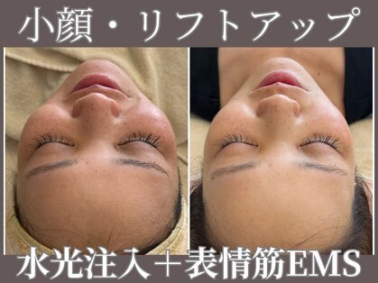 【肌管理×小顔・毛穴改善フェイシャルサロン】MavY.堺駅前店【9/10 NEW OPEN(予定)】の写真