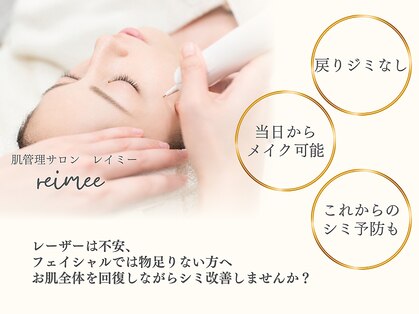 レイミー(reimee)の写真