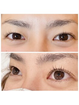 アットイース(at ease)/◎セラムラッシュリフト導入