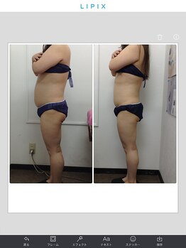 健康痩身研究所 蟹江店/ビフォーアフター