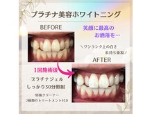 ホワイトニングプラス(Whitening+)の雰囲気（歯科衛生士在籍！しっかりサポートさせていただきます(^^♪）