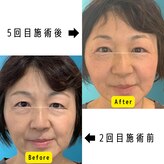ネクスフィット(Nexfit)