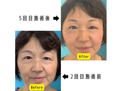 ネクスフィット(Nexfit)の写真