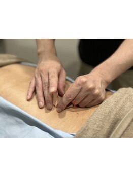 鍼灸施術を受けたい