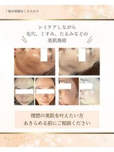 まる整体院/シミのお悩み方