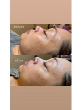 コクシネル(coccinelle)/韓国発！ツヤ肌×リフトUP体験☆