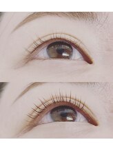 チステ(chiste)/大人気！マイラミネーション