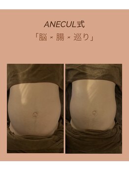 アネクル(ANECUL)/