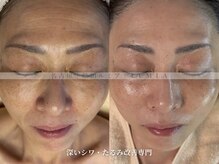 ルミア(LUMIA)の雰囲気（年齢による深いシワ・たるみを丁寧にケア）