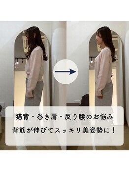 なぎのき鍼灸治療院/姿勢・骨盤矯正ビフォーアフター