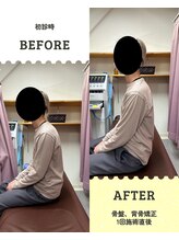 松山ひがし接骨院/ビフォーアフター