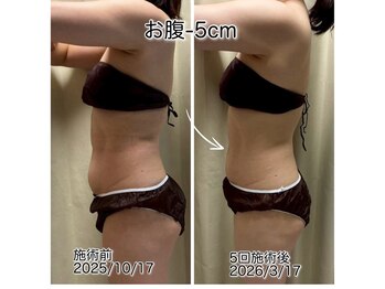 クールスパ(COOL SPA)/【100カップ途中経過】