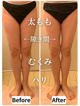 リエンシン(Riensin)/【レッドショット】下半身痩せ◎