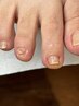 【足爪メンテナンス】足爪カット+爪周りケア