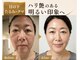 サロンチオリ 烏丸(Salon Chiori)の写真/目の下たるみ・クマで老けて疲れて見える大人女性へ。目元だけでなく、顔全体を引き上げる小顔矯正