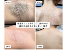 ミーラブ 鹿児島(miilove)の雰囲気（脱毛実績２０年。デリケートな子供脱毛から痛みが苦手な方にも◎）
