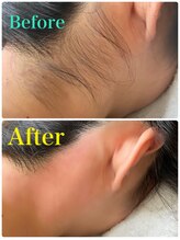 トゥエイト(to 8..)/WAX脱毛　うなじ