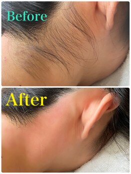 トゥエイト(to 8..)/WAX脱毛 うなじ