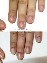 マリーロール 梅田店(Marie Laure)/自爪育成/深爪矯正/ネイルケア