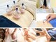からだととのえ家さん 健美楽寿鍼灸院 整骨院の写真/心と体をほぐして整える♪美容鍼/全身鍼/全身灸/アロマリンパ/足つぼ/カッピング/もみほぐし…組合わせ自由