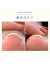 【巻き爪ケア】初めてのお客様専用
