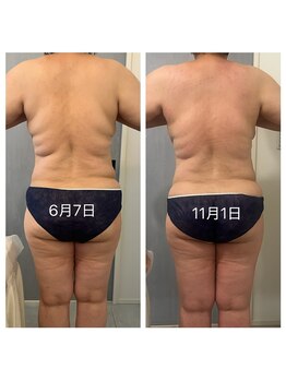 美温(mion)/痩身＆疲労回復