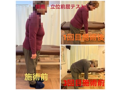 リファイン(Refine)の写真