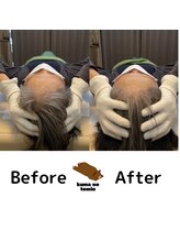 クマの冬眠 高知店/頭スッキリ