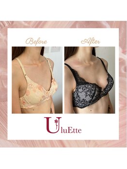 ウルエッテ(UluEtte)/特許庁認定[循環バスト]福岡育乳