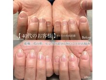 エルミュ(elmu)の雰囲気（自爪育成）