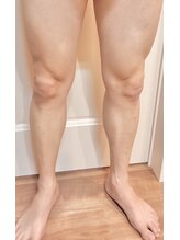 パーミル 千里丘店(per mille‰)/私の足のお写真です！