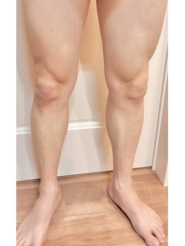 パーミル 千里丘店(per mille‰)/私の足のお写真です!