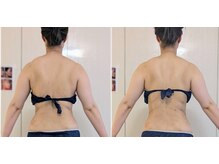 イクヨノ ビューティーサロン(194's beauty salon)の雰囲気(40代からの本気の痩身(体質別ケア)1回)