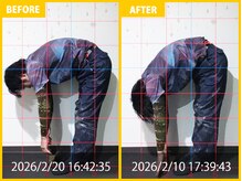 整体院 元 光の森店/ひどい腰痛の悩み