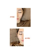 プレッシュ(Presh)/【小顔矯正】