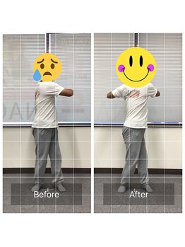 ナオル整体 勝田台院(NAORU整体)/施術事例【50代男性】腰のひねり